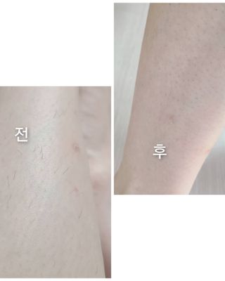 바랩 VA-WH300 미니 왁스 워머기 왁싱 기획세트 — 5점을 준 리뷰어가 2021년 8월 올린 사용 사진