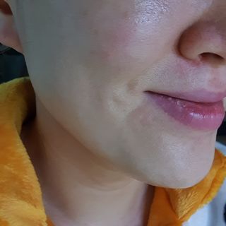 체르엠 그린 케비어 더블워터 마스크팩 5매입  2팩 — 5점을 준 리뷰어가 2021년 10월 올린 사용 사진