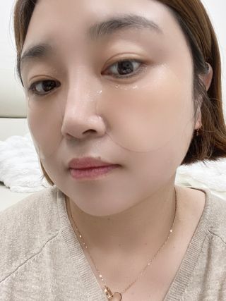 트리마이 인리치드 비타브라이트 겔 아이패치 — 5점을 준 리뷰어가 2024년 2월 올린 사용 사진