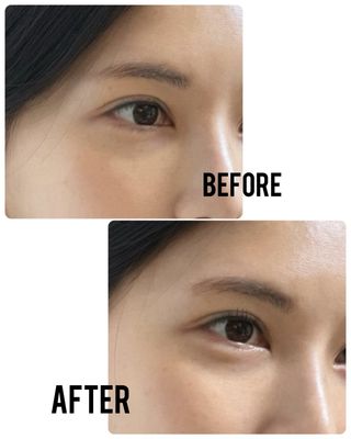 더소설 소설 블랙아이래쉬 세럼 10g(SOSEOL BLACK EYELASH SERUM 10g) — 5점을 준 리뷰어가 2023년 12월 올린 사용 사진