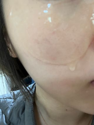 트리마이 인리치드 비타브라이트 겔 아이패치 — 5점을 준 리뷰어가 2024년 2월 올린 사용 사진