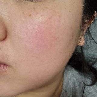 레드투래드 센서티브 어메이징 앰플 30ml — 5점을 준 리뷰어가 2021년 11월 올린 사용 사진