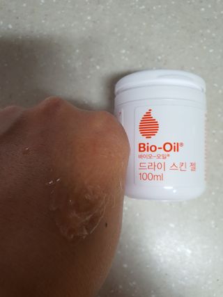 바이오오일 [바이오-오일] 드라이 스킨 젤 100ml — 5점을 준 리뷰어가 2021년 12월 올린 사용 사진