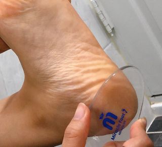 미라클풋 유리발각질제거기 물없이 쓱싹쓱싹 몇번만에 발각질 완벽제거 — 4.5점을 준 리뷰어가 2021년 9월 올린 사용 사진