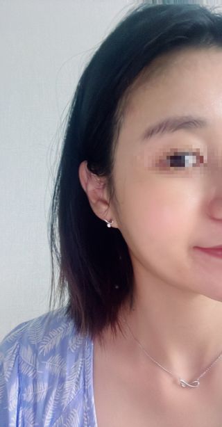 세뚜아(Cettua) 세뚜아 스티키 포어 패치 Cettua Sticky Pore Patch — 5점을 준 리뷰어가 2023년 8월 올린 사용 사진