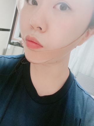 아이디플라코스메틱 아이디 페이스핏 마이너스 밴드 v2 — 5점을 준 리뷰어가 2021년 6월 올린 사용 사진