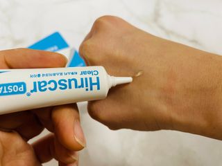 히루스카 포스트아크네 클리어 — 5점을 준 리뷰어가 2021년 1월 올린 사용 사진