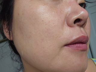 ★스마트 스토어 [올바이오] 더마크림 라이트 크림 130ml 저자극 보습 가려움개선 — 4.5점을 준 리뷰어가 2025년 2월 올린 사용 사진