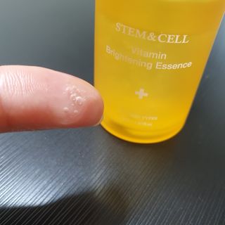 체르엠 비타민 브라이트닝 에센스 + 콜라겐앰플 세트 — 5점을 준 리뷰어가 2021년 7월 올린 사용 사진