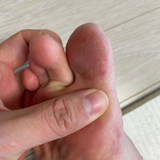 미라클풋 유리발각질제거기 물없이 쓱싹쓱싹 몇번만에 발각질 완벽제거 — 4점을 준 리뷰어가 2021년 10월 올린 사용 사진