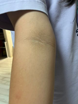 비엔디 프리용[한/영]BnD 바디 미백 겨드랑이 크림 — 3점을 준 리뷰어가 2024년 10월 올린 사용 사진