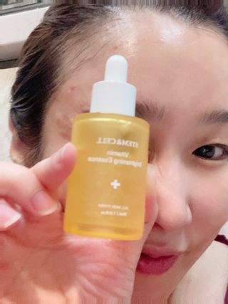 체르엠 스템앤셀 비타민 브라이트닝 에센스 30ml 1개 — 5점을 준 리뷰어가 2022년 2월 올린 사용 사진