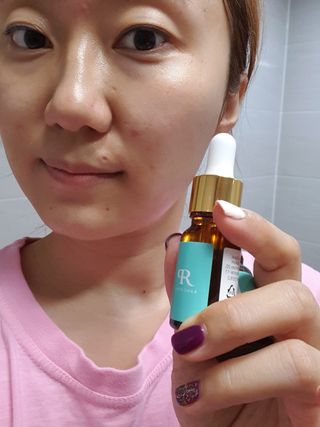 랑팡 EGF+FGF 10ppm 리포좀 앰플 원액 10ml — 5점을 준 리뷰어가 2021년 11월 올린 사용 사진