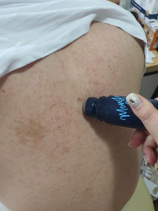 [바록스] 류현진 올인원 바디릴렉싱 몬스터겔 50ml — 4.5점을 준 리뷰어가 2021년 3월 올린 사용 사진