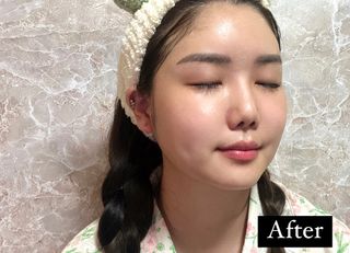 베지톨로지 비니페린 브라이트닝 마스크 (10매입) — 5점을 준 리뷰어가 2022년 7월 올린 사용 사진