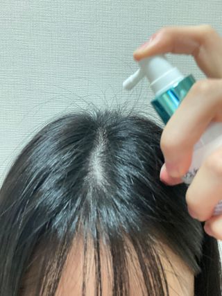 모두발라 탈모집중케어 헤어토닉 — 5점을 준 리뷰어가 2021년 12월 올린 사용 사진