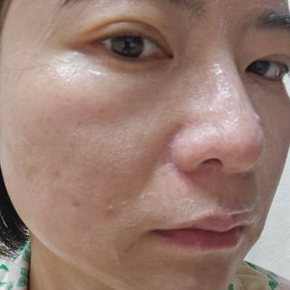 더메디코템 일루미네이팅 오로라 에멀젼마스크 — 5점을 준 리뷰어가 2025년 6월 올린 사용 사진