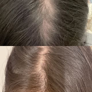 모두발라 탈모집중케어 헤어토닉 — 5점을 준 리뷰어가 2022년 1월 올린 사용 사진