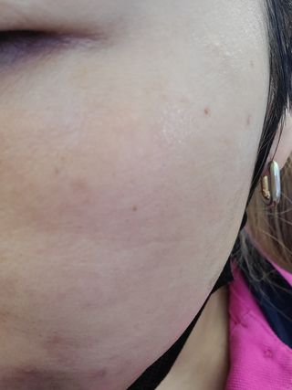 리더스코스메틱 리더스 카밍 바이오틱스 퀵 수딩 패드 — 5점을 준 리뷰어가 2022년 6월 올린 사용 사진