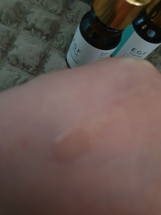 랑팡 EGF+FGF 10ppm 리포좀 앰플 원액 10ml — 5점을 준 리뷰어가 2021년 9월 올린 사용 사진