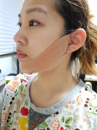 아이디플라코스메틱 아이디 페이스핏 마이너스 밴드 v2 — 5점을 준 리뷰어가 2021년 5월 올린 사용 사진