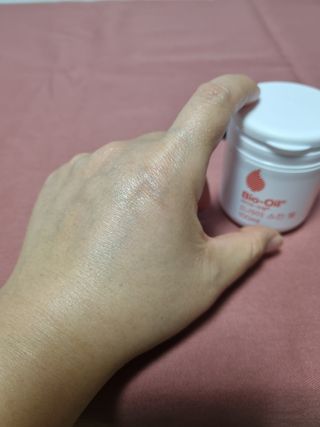 바이오오일 [바이오-오일] 드라이 스킨 젤 100ml — 5점을 준 리뷰어가 2021년 12월 올린 사용 사진