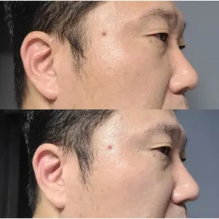 그리니프 포맨 내추럴 비비크림 50g — 5점을 준 리뷰어가 2023년 5월 올린 사용 사진