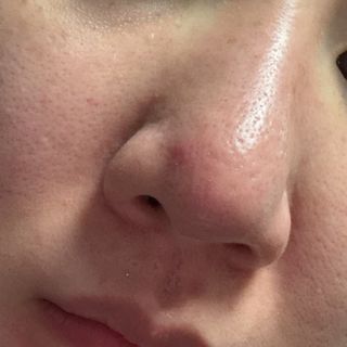 나우 [리브엠] 화해 1등 각질 클렌저! 시카좀 카밍 딥 클렌징 폼 — 4.5점을 준 리뷰어가 2025년 6월 올린 사용 사진