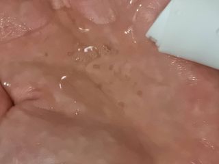 스칼프메드 레드캡슐바이옴 두피케어 프로바이오틱스 유산균 두피관리 세트 — 3.5점을 준 리뷰어가 2021년 4월 올린 사용 사진