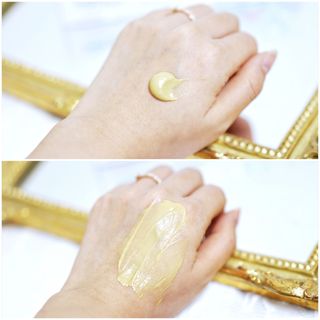 건선/아토/습진/민감성 피부 천연보습진정크림 소리온 크림 & 센시티브 크림 50g — 5점을 준 리뷰어가 2022년 1월 올린 사용 사진