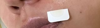 올리브영 엘라밴드 하이드로 도트 스팟패치 12mm, 티트리 — 4점을 준 리뷰어가 2022년 10월 올린 사용 사진