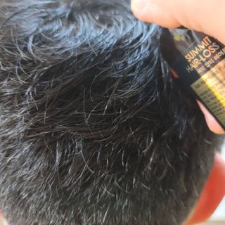 썸헤어 / SUMHAIR 썸헤어 써밋 안티 헤어로스 토닉 — 4.5점을 준 리뷰어가 2021년 5월 올린 사용 사진