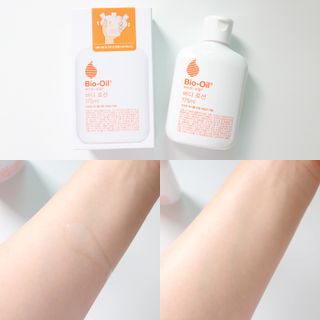 바이오오일 [바이오-오일] 바디 로션 175ml — 5점을 준 리뷰어가 2021년 10월 올린 사용 사진