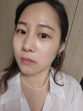 3M 넥스케어 블레미쉬 여드름패치 릴리프 111매(짜기 전 케어) +알코올스왑 증정 — 5점을 준 리뷰어가 2024년 5월 올린 사용 사진