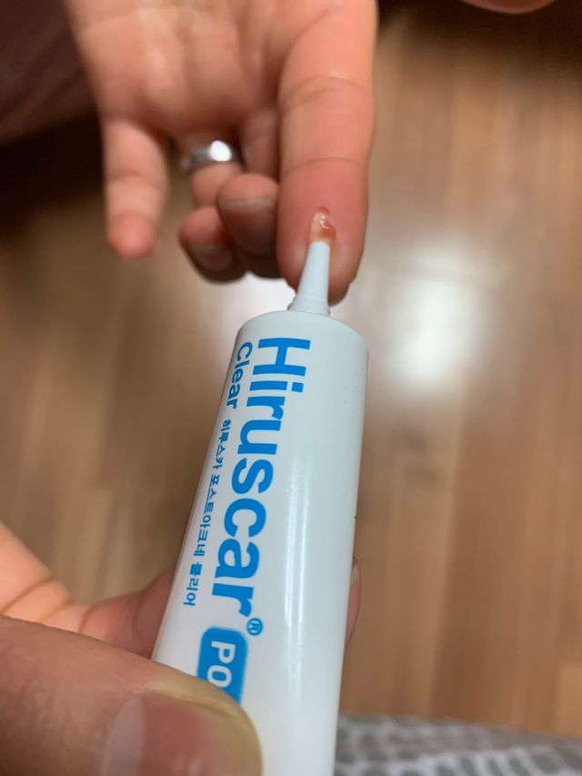 히루스카 포스트아크네 클리어 리뷰 사진