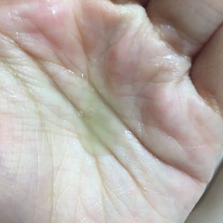 성분에디터 그린토마토 포어 리프팅 앰플 플러스 — 5점을 준 리뷰어가 2021년 7월 올린 사용 사진
