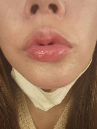 [후르디아] 올리브영 착한보습 비건 립버터 2종 — 5점을 준 리뷰어가 2023년 1월 올린 사용 사진