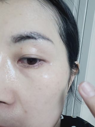 팜스테이 티트리 바이옴 카밍 아이크림 — 5점을 준 리뷰어가 2022년 2월 올린 사용 사진