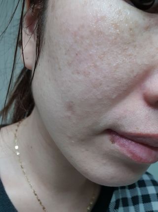 셀바이져 지우개 미스트 피부 보호 입주변 트러블 진정 케어 아기 안개분사 미스트 — 4점을 준 리뷰어가 2021년 2월 올린 사용 사진