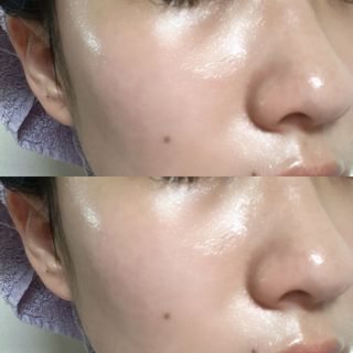Tween.Ty Skin 트웬티스킨 멀티케어 스틱밤 — 5점을 준 리뷰어가 2022년 4월 올린 사용 사진