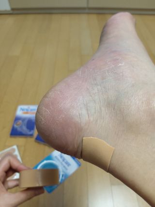 3M 넥스케어 물집방지쿠션테이프 1매 + 물집방지패드 10매 — 5점을 준 리뷰어가 2024년 3월 올린 사용 사진