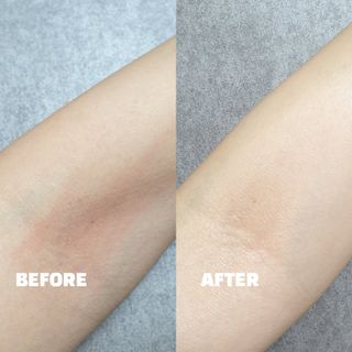 건선/아토/습진/민감성 피부 천연보습진정크림 소리온 크림 & 센시티브 크림 50g — 5점을 준 리뷰어가 2022년 1월 올린 사용 사진