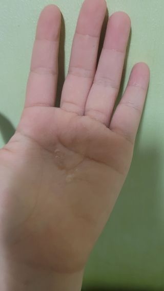 아르비엔 마일드케어 비건 시카세럼 — 4점을 준 리뷰어가 2021년 2월 올린 사용 사진
