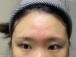 듀오코리아 [듀오] 피부맞춤형 저자극 클렌징밤 1종 랜덤발송 (모공케어,안색개선,안티에이징,블랙헤드) — 3.5점을 준 리뷰어가 2022년 6월 올린 사용 사진