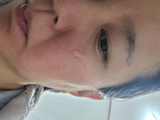 레드투래드 센서티브 어메이징 앰플 30ml — 5점을 준 리뷰어가 2021년 9월 올린 사용 사진