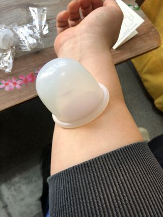 메디미케이알 커핑테라피 실리콘부항마사지 리프팅 페이스+바디 안티 셀룰 라이트 6pcs — 5점을 준 리뷰어가 2021년 2월 올린 사용 사진