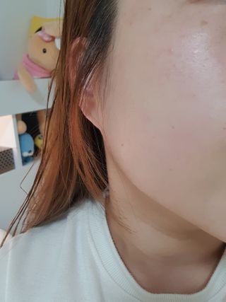 메디필 레드 락토 콜라겐 필링패드 — 5점을 준 리뷰어가 2021년 2월 올린 사용 사진