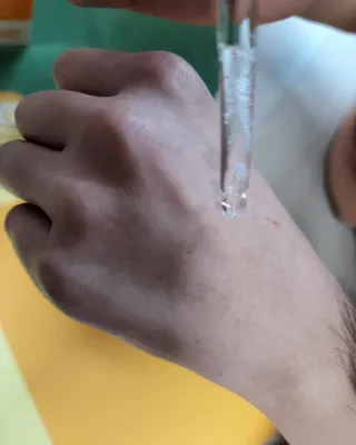 체르엠 스템앤셀 비타민 브라이트닝 에센스 30ml 1개 — 5점을 준 리뷰어가 2022년 4월 올린 사용 사진