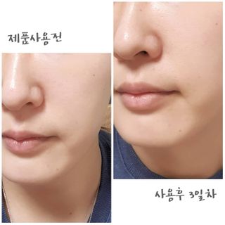 이엔코스 알부틴5프로화이트닝세럼 — 5점을 준 리뷰어가 2021년 2월 올린 사용 사진