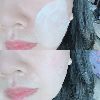 리더스코스메틱 리더스 카밍 바이오틱스 퀵 수딩 패드 — 5점을 준 리뷰어가 2022년 6월 올린 사용 사진